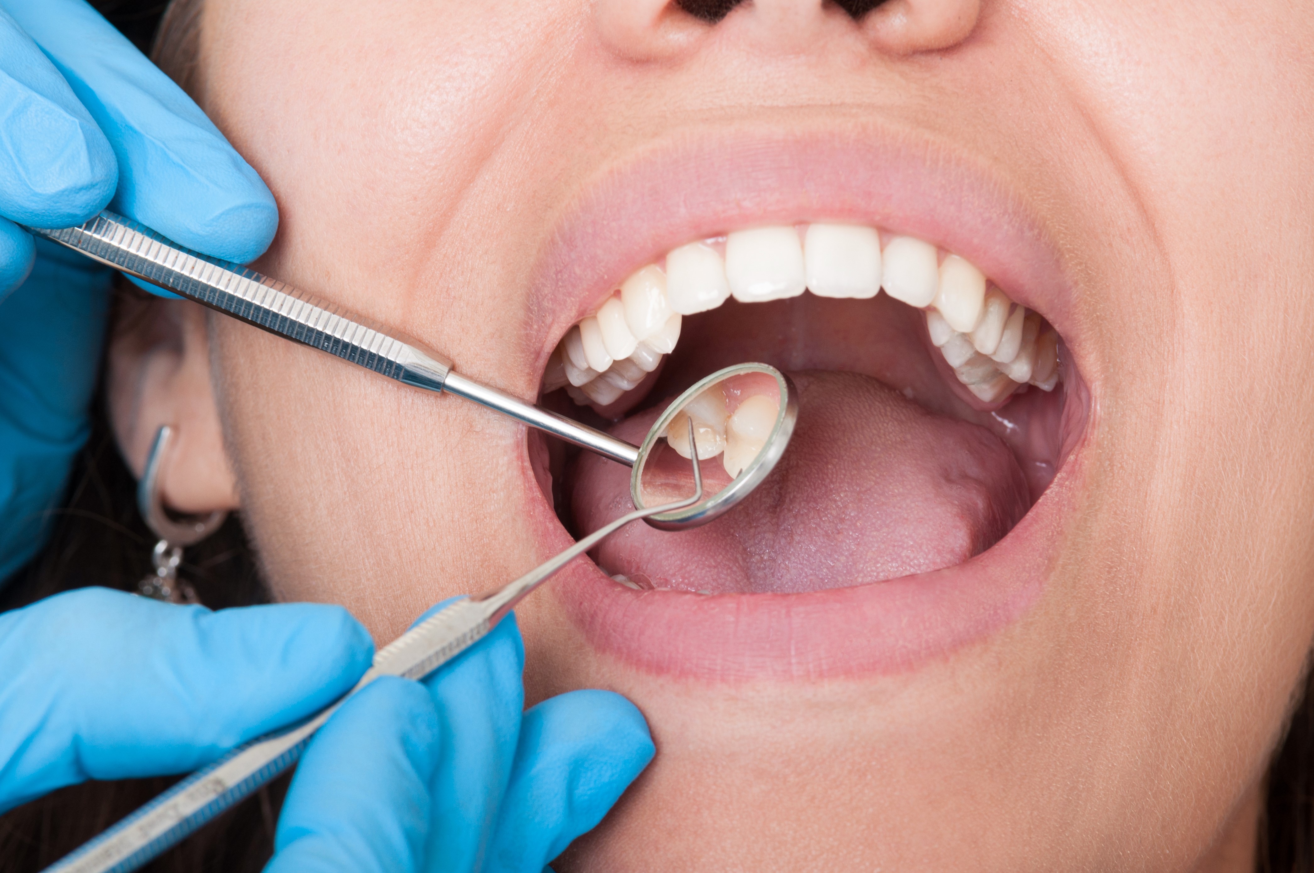 Hygienist - Deans Dental Care